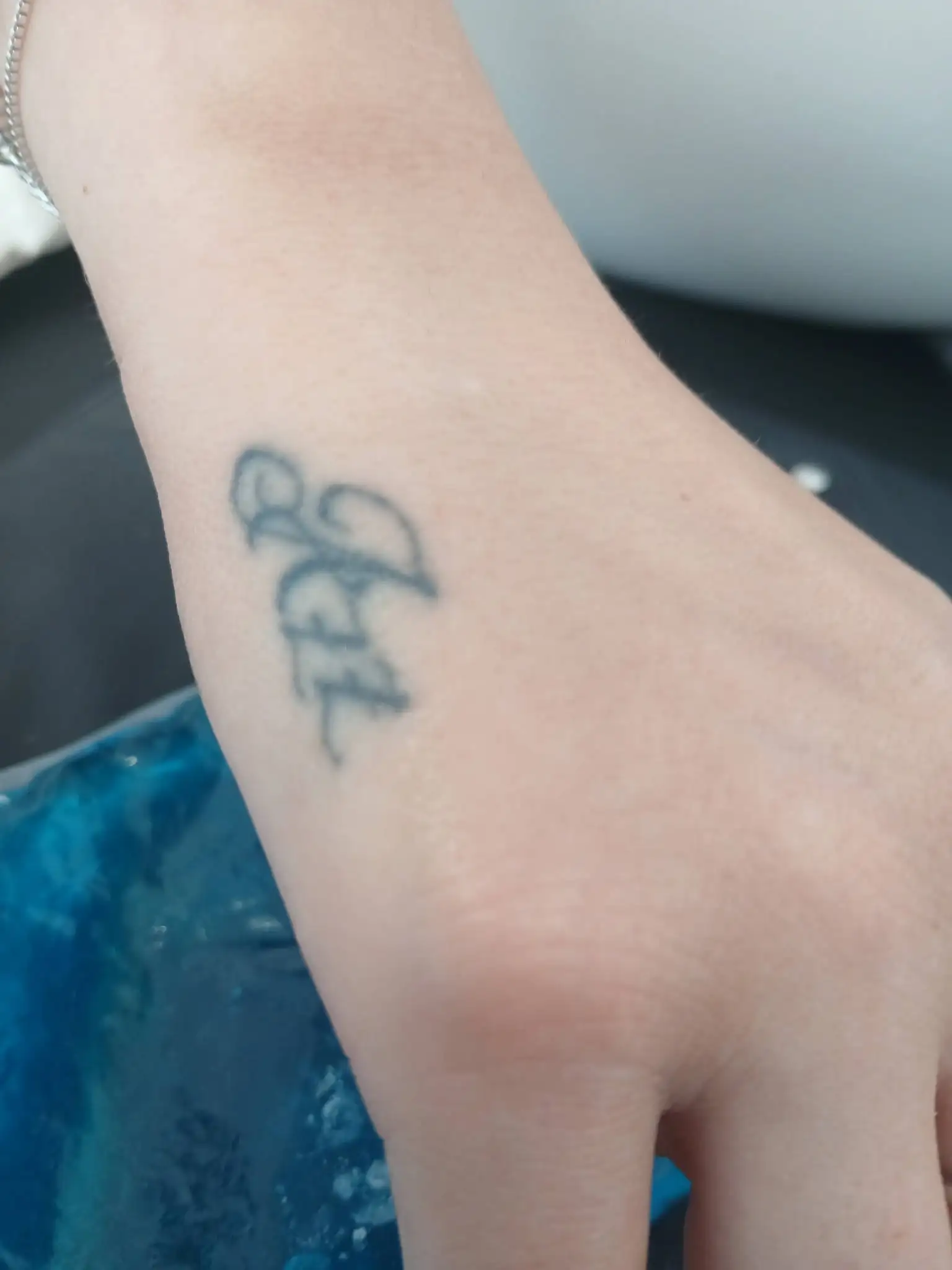 Laser being used to fade a tattoo on an arm